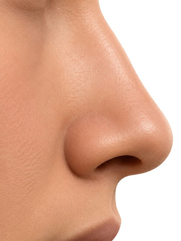 ¿Por qué cada Rinoplastia es diferente?